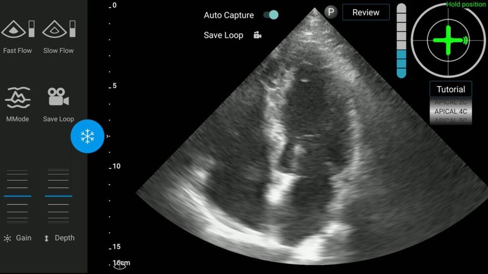 “You don’t have to be a cardiologist or a sonographer. The operator can be a nurse or a paramedic,” says UltraSight CEO Davidi Vortman. (Courtesy of UltraSight)